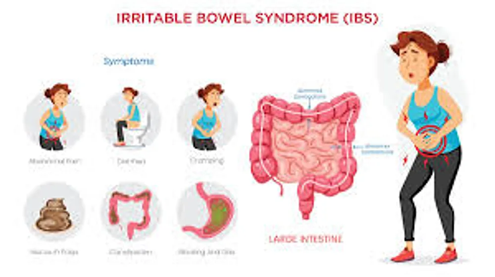 Illustration of the digestive system relating to irritable bowel syndrome New Day Therapies Hull